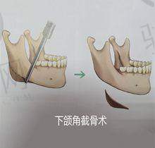 西安俪时代面部提升特色