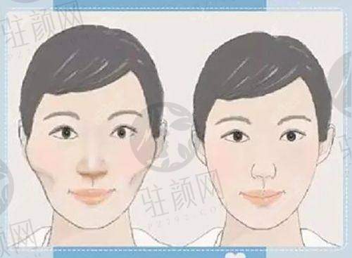 杭州韩美整形医院：韩系风格特色
