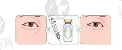 影响深圳激光祛斑价格的因素