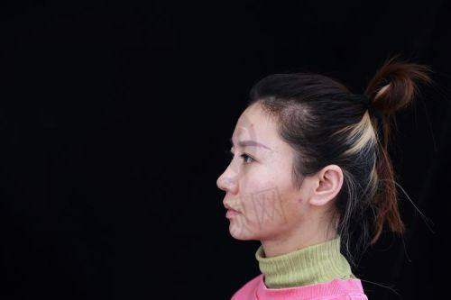 杭州其他非凡鼻整形医生
