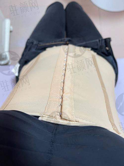 北京口碑好的吸脂医生排名