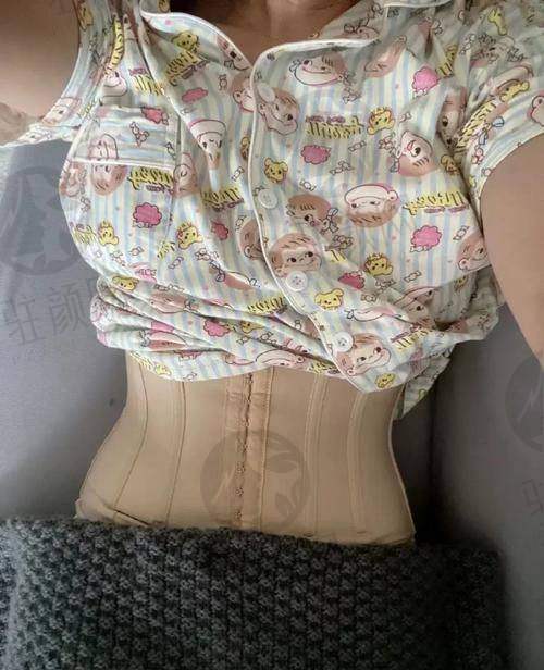 西安部分医院抽脂特色技术