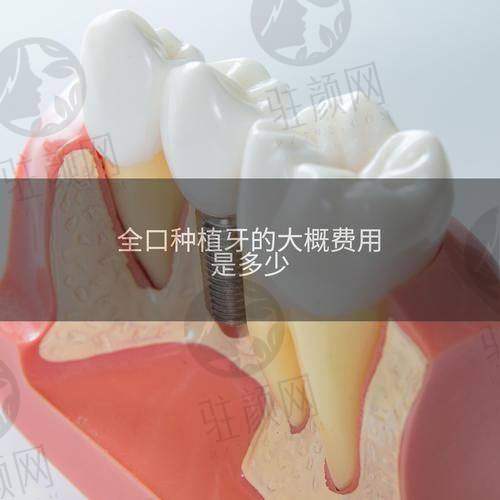 成都种植牙哪家医院性价比最高？新桥、极光等前十医院技术、价格、医生团队信息全揭秘！ 