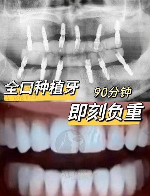 正畸价格实惠多样