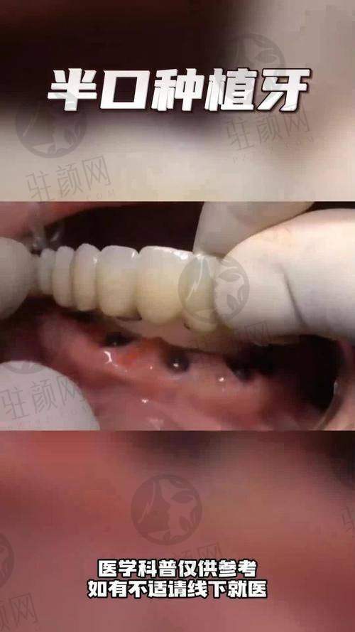 台州排名前十口腔医院的收费标准对比
