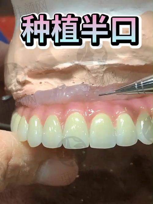 台州排名前十口腔医院的特色项目介绍