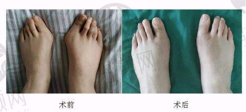 发展历程，步步为营