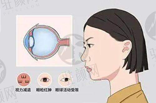 枣庄爱尔眼科医院：国内连锁优势