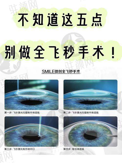 2025年优惠活动