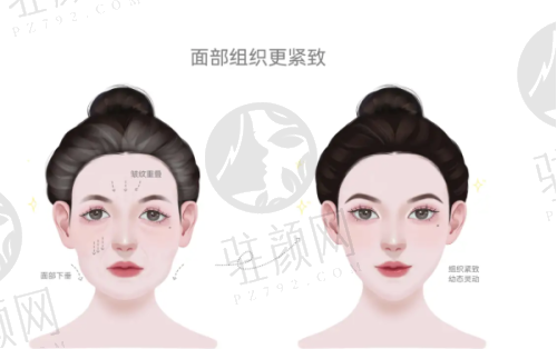 东莞市人民医院皮肤科医生
