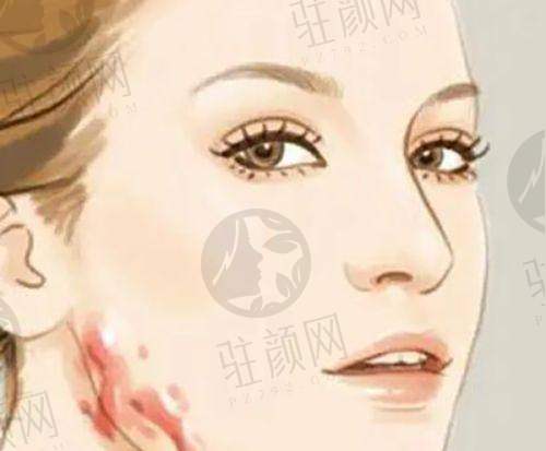无锡市人民医院：专精全方面的皮肤科团队