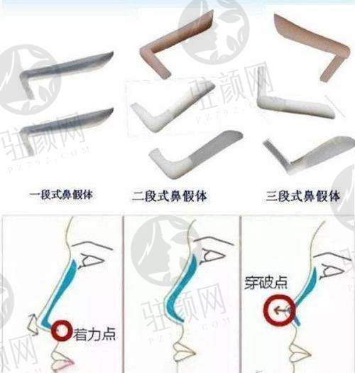 疤痕软化针注意事项