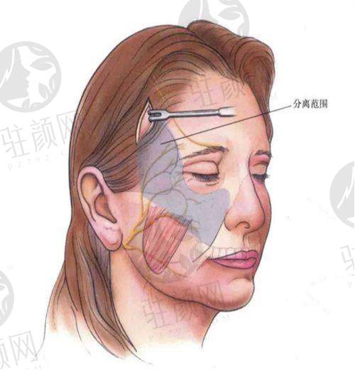 2025韩国拉皮手术好的医院推荐：清潭first、迪美等多家医院各展优势 