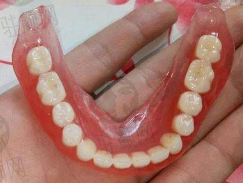 深圳美莱口腔医院种植牙优势多方面展现