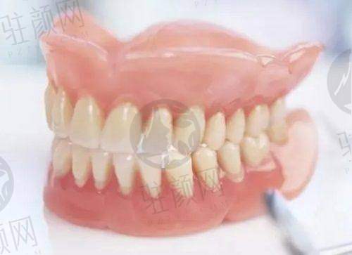 深圳美莱口腔种植牙适合人群广泛