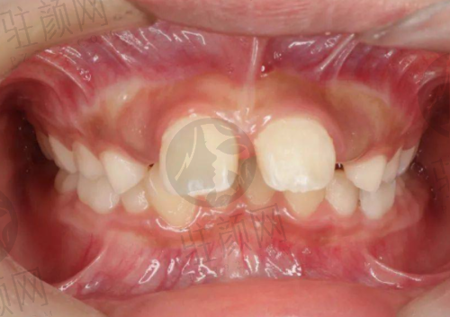 深圳凯伦口腔口碑怎么样