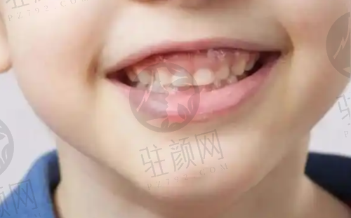 深圳拜博口腔整体实力