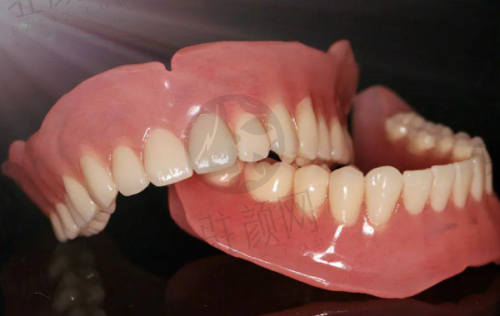 严格的消毒措施