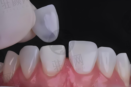 精良的技术与设备