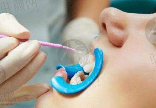 深圳美莱口腔正规性有保护