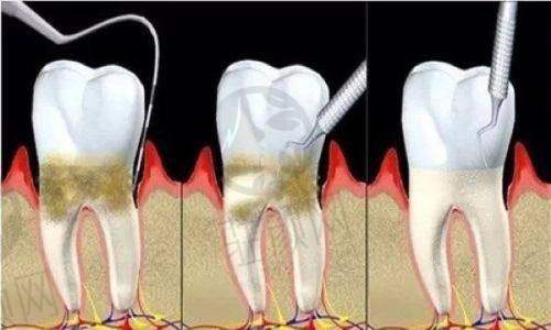深圳麦芽口腔医疗保险报销流程