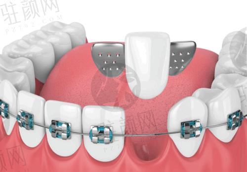 深圳麦芽口腔:正畸医生实力雄厚,价格体系清晰