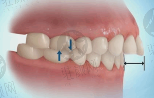 深圳福华口腔口碑评价