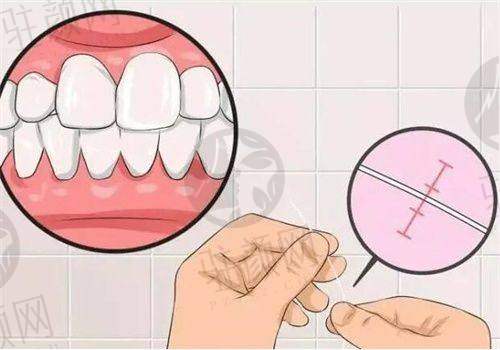 深圳凯伦口腔看牙技术怎么样