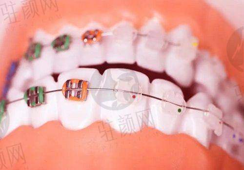 深圳市口腔医院:深圳国有口腔top1,实力与性价比并存