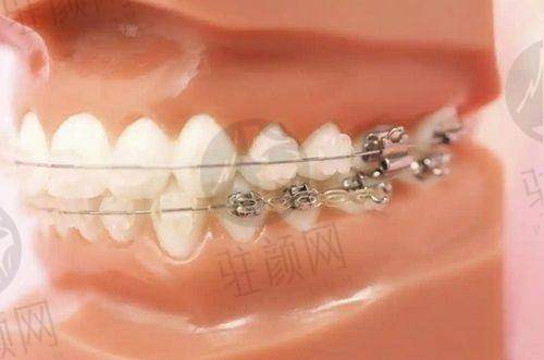 深圳美莱口腔医院相关信息