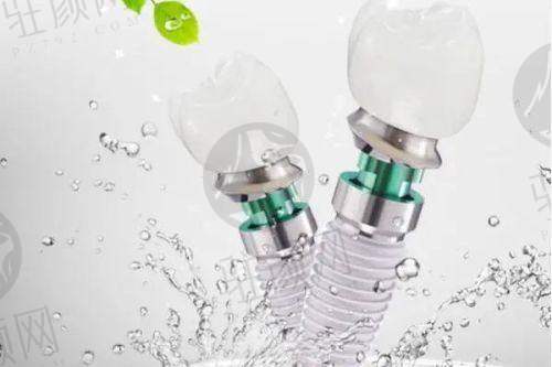 真实患者实例见证深圳美莱口腔种植牙成效