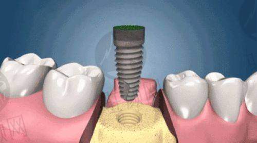 深圳新安麦芽口腔门诊部特色诊疗项目