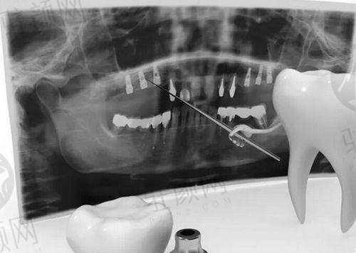 深圳新安麦芽口腔门诊部预约挂号方式