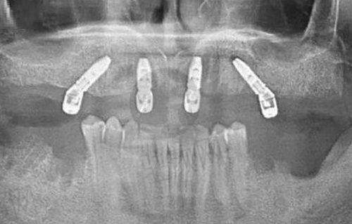 真实的患者口碑