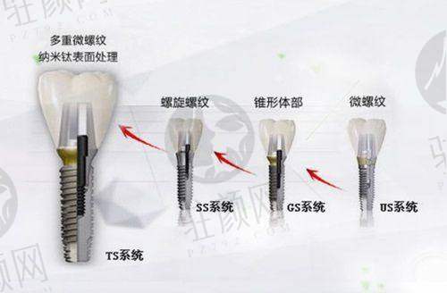 深圳福华口腔牙齿矫正项目及收费情况